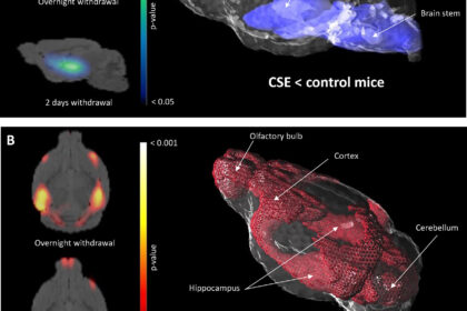 PASREL Imagerie – Case studie | Development of a murine model of tobacco exposure using 18F-FDG PET imaging